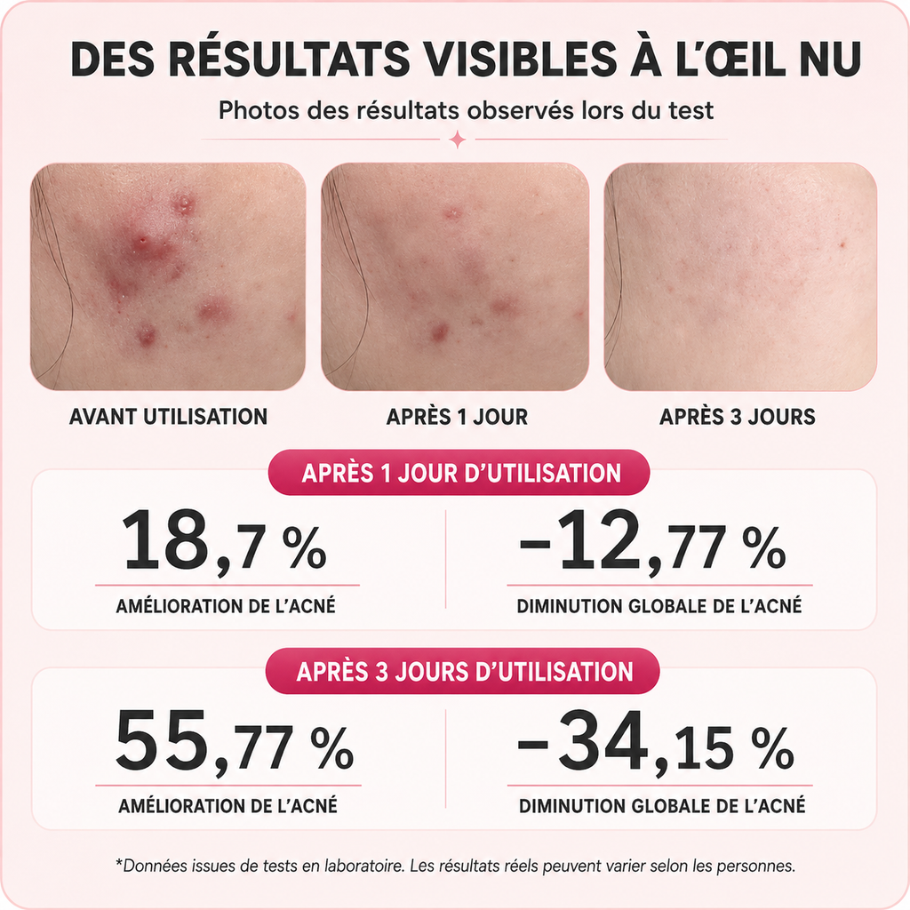 Patchs LED Anti-Imperfections- Photothérapie Rouge & Bleue | Calmeya